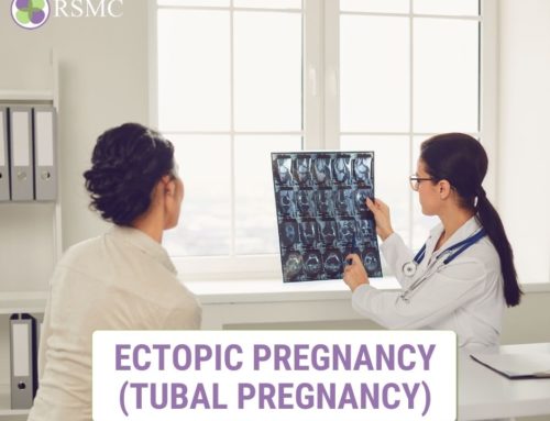 Ectopic Pregnancy (Tubal Pregnancy)