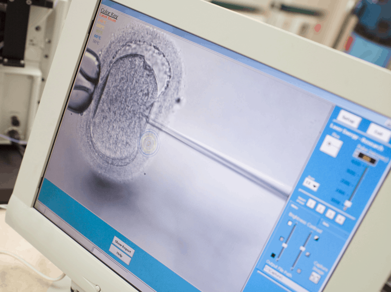 ICSI-services-for-fertility-treatment icsi infertility