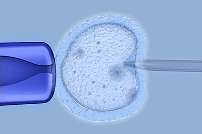 Fertility Treatments